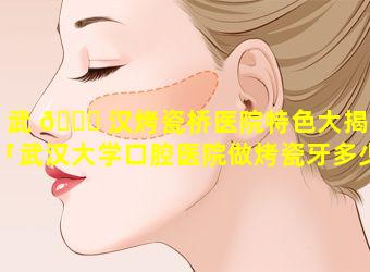 武 🐞 汉烤瓷桥医院特色大揭秘「武汉大学口腔医院做烤瓷牙多少钱」